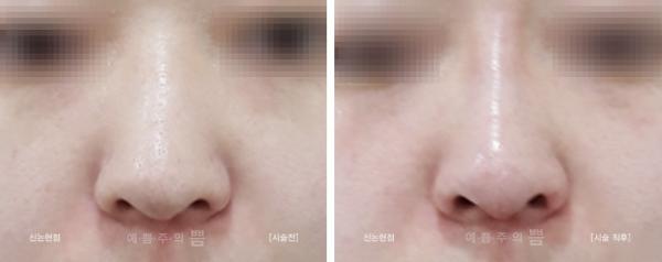 하이코