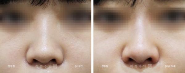 바비코